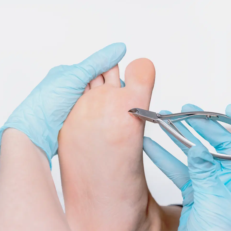 RUCK® INSTRUMENT Nahatangid, roostevaba teras, 10.5 cm/5 mm, meditsiiniseade - Image 5